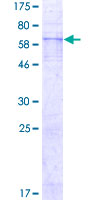 12.5% SDS-PAGE analysis of ab152357 stained with Coomassie Blue.