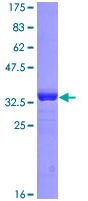 ab114259 analysed by 12.5% SDS-PAGE and stained with Coomassie Blue.