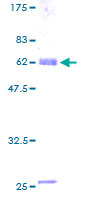 ab161022 on a 12.5% SDS-PAGE stained with Coomassie Blue.