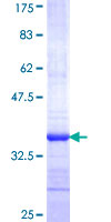 ab161023 on a 12.5% SDS-PAGE stained with Coomassie Blue.