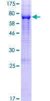 ab161455 on a 12.5% SDS-PAGE stained with Coomassie Blue.