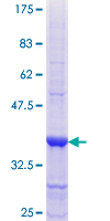 ab158997 on a 12.5% SDS-PAGE stained with Coomassie Blue.