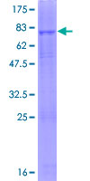 ab158060 on a 12.5% SDS-PAGE stained with Coomassie Blue.