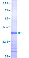 ab158061 on a 12.5% SDS-PAGE stained with Coomassie Blue.