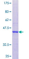 ab159356 on a 12.5% SDS-PAGE stained with Coomassie Blue.