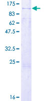 ab160975 on a 12.5% SDS-PAGE stained with Coomassie Blue.