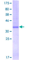 ab160976 on a 12.5% SDS-PAGE stained with Coomassie Blue.