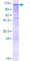ab153155 on a 12.5% SDS-PAGE stained with Coomassie Blue.