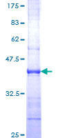 ab153156 on a 12.5% SDS-PAGE stained with Coomassie Blue.