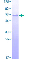 ab158364 on a 12.5% SDS-PAGE stained with Coomassie Blue.