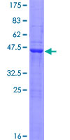 ab163775 on a 12.5% SDS-PAGE stained with Coomassie Blue.