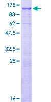 ab153458 on a 12.5% SDS-PAGE stained with Coomassie Blue.
