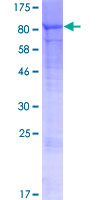 ab158366 on a 12.5% SDS-PAGE stained with Coomassie Blue.