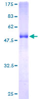 ab162830 on a 12.5% SDS-PAGE stained with Coomassie Blue.