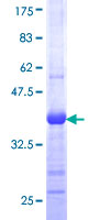 ab158368 on a 12.5% SDS-PAGE stained with Coomassie Blue.