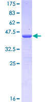 ab114440 analysed on a 12.5% SDS-PAGE gel stained with Coomassie Blue.