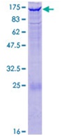 12.5% SDS-PAGE analysis of ab132958 stained with Coomassie Blue.