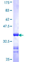 ab158371 on a 12.5% SDS-PAGE stained with Coomassie Blue.