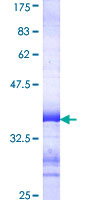 ab158372 on a 12.5% SDS-PAGE stained with Coomassie Blue.