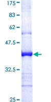ab166193 on a 12.5% SDS-PAGE stained with Coomassie Blue.
