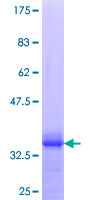 ab158374 on a 12.5% SDS-PAGE stained with Coomassie Blue.