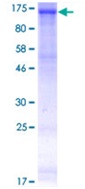 12.5% SDS-PAGE analysis of ab132962 stained with Coomassie Blue.