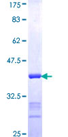 ab158376 on a 12.5% SDS-PAGE stained with Coomassie Blue.