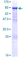 ab158378 on a 12.5% SDS-PAGE stained with Coomassie Blue.