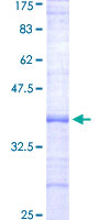 ab158379 on a 12.5% SDS-PAGE stained with Coomassie Blue.
