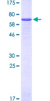 ab158321 on a 12.5% SDS-PAGE stained with Coomassie Blue.