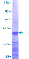 ab159483 on a 12.5% SDS-PAGE stained with Coomassie Blue.