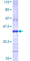 ab159917 on a 12.5% SDS-PAGE stained with Coomassie Blue.