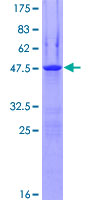 ab162943 on a 12.5% SDS-PAGE stained with Coomassie Blue.