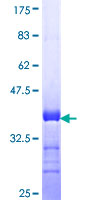 ab162944 on a 12.5% SDS-PAGE stained with Coomassie Blue.