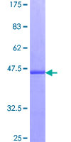 ab158380 on a 12.5% SDS-PAGE stained with Coomassie Blue.