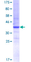 12.5% SDS-PAGE analysis of ab152367 stained with Coomassie Blue.