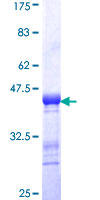 ab162866 on a 12.5% SDS-PAGE stained with Coomassie Blue.