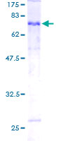 ab162445 on a 12.5% SDS-PAGE stained with Coomassie Blue.