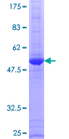 ab158695 on a 12.5% SDS-PAGE stained with Coomassie Blue.