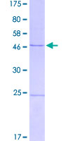 ab152282 on a 12.5% SDS-PAGE stained with Coomassie Blue.
