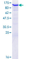 ab161753 on a 12.5% SDS-PAGE stained with Coomassie Blue.