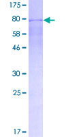 ab158384 on a 12.5% SDS-PAGE stained with Coomassie Blue.