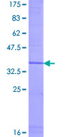 ab161330 on a 12.5% SDS-PAGE stained with Coomassie Blue.