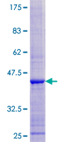 ab163962 on a 12.5% SDS-PAGE stained with Coomassie Blue.