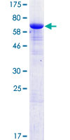 ab163558 on a 12.5% SDS-PAGE stained with Coomassie Blue.