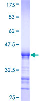 ab162720 on a 12.5% SDS-PAGE stained with Coomassie Blue.
