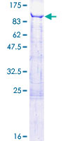 ab164177 on a 12.5% SDS-PAGE stained with Coomassie Blue.