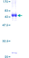 ab158385 on a 12.5% SDS-PAGE stained with Coomassie Blue.