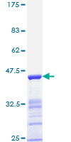 ab114181 on a 12.5% SDS-PAGE Stained with Coomassie Blue.