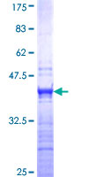 ab164279 on a 12.5% SDS-PAGE stained with Coomassie Blue.